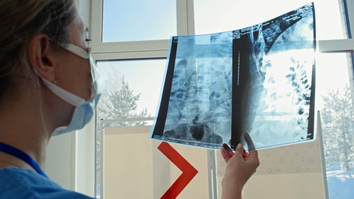 Radiografie nei triage: l’ordine dei medici approva, i sindacati no