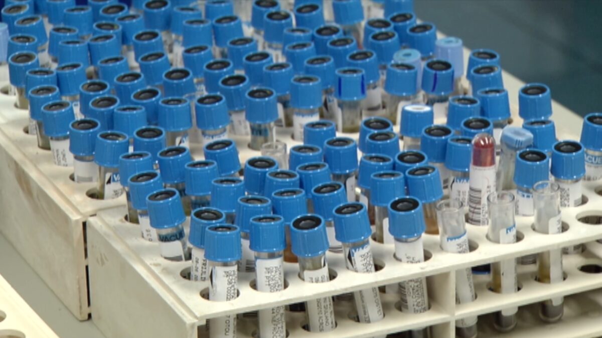 Letrozolo: parla il medico sportivo Endrizzi